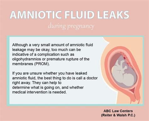 leaking amniotic fluid symptoms|Amniotic Fluid: What is It and Signs of Leaking